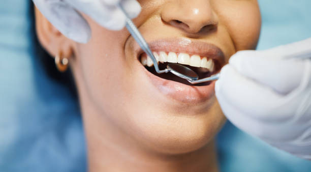 Best Weekend Emergency Dental Services in Clover Creek, WA